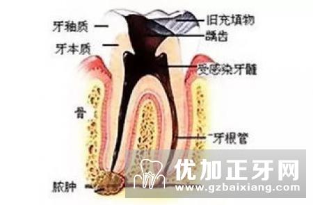 牙齿松动？8种方法来解决！