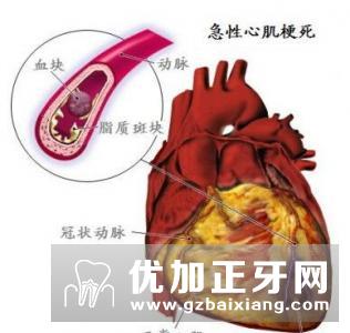 刺血拔罐疗法的注意事项